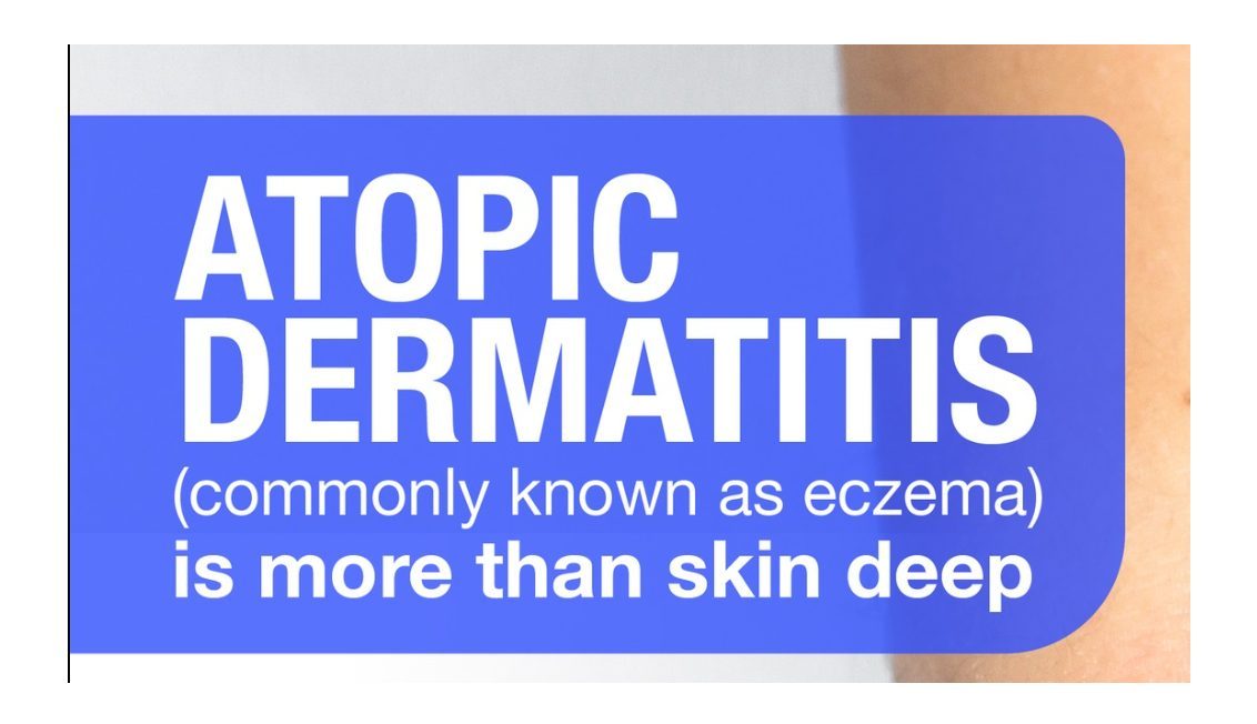 A dermatologist who cares - Dr Peter Hogan in Sydney